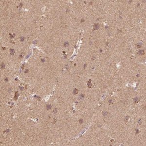 Anti-AP2B1 antibody produced in rabbit 