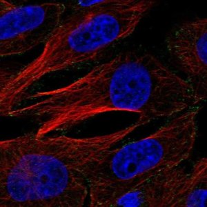 Anti-AP2M1 antibody produced in rabbit 
