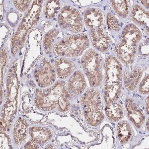 Anti-AP3M1 antibody produced in rabbit 