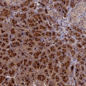 Anti-AP4E1 antibody produced in rabbit 