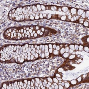 Anti-AP4S1 antibody produced in rabbit 