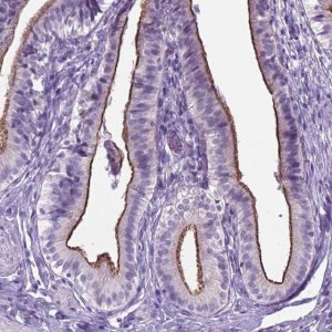Anti-AP5B1 antibody produced in rabbit 