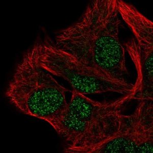 Anti-AP5B1 antibody produced in rabbit 