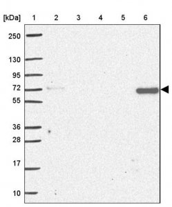 Anti-AP5M1 antibody produced in rabbit HPA055768-100UL