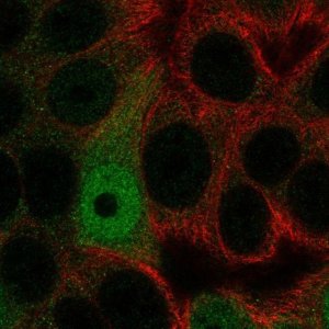 Anti-AP5S1 antibody produced in rabbit 