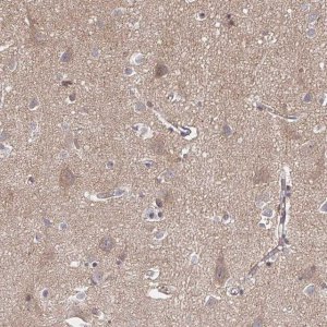 Anti-APBB1 antibody produced in rabbit 