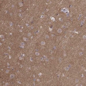 Anti-APC antibody produced in rabbit 