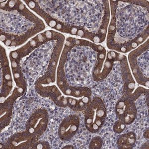 Anti-APC antibody produced in rabbit 