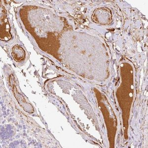 Anti-APCS antibody produced in rabbit HPA053294-100UL