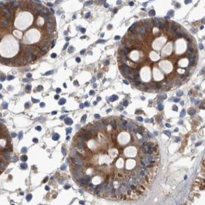 Anti-APEH antibody produced in rabbit 
