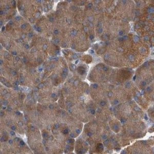 Anti-APEH antibody produced in rabbit 