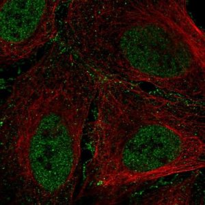 Anti-ARID1B antibody produced in rabbit 