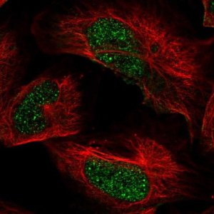 Anti-ARID2 antibody produced in rabbit 