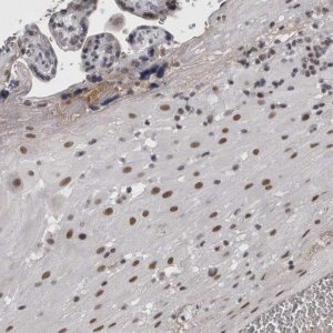 Anti-ARID4B antibody produced in rabbit 