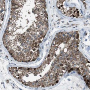 Anti-ARID5B antibody produced in rabbit 