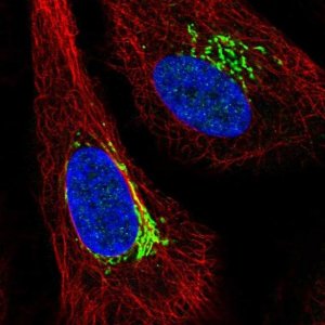 Anti-ARIH1 antibody produced in rabbit 