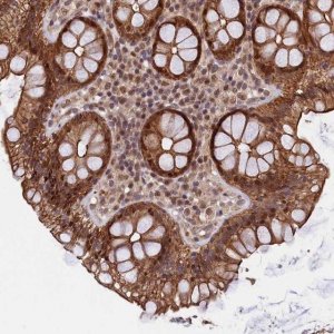 Anti-ARL14EP antibody produced in rabbit 