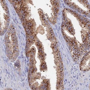 Anti-ARL16 antibody produced in rabbit 
