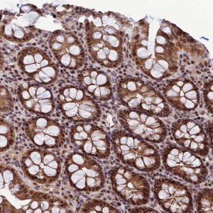 Anti-ARL2 antibody produced in rabbit 