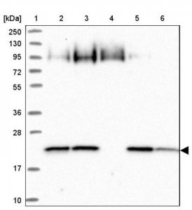 Anti-ARL8A antibody produced in rabbit 
