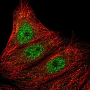 Anti-ARMC5 antibody produced in rabbit 