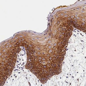Anti-ARMC6 antibody produced in rabbit 