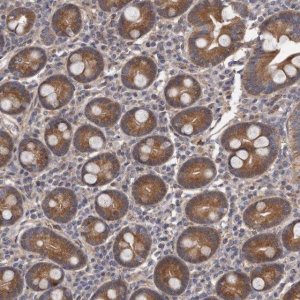 Anti-ARMCX1 antibody produced in rabbit 
