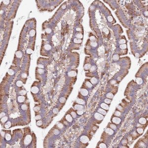 Anti-ARMCX6 antibody produced in rabbit 