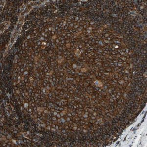 Anti-ARPC2 antibody produced in rabbit 