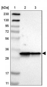 Anti-ARPC2 antibody produced in rabbit 