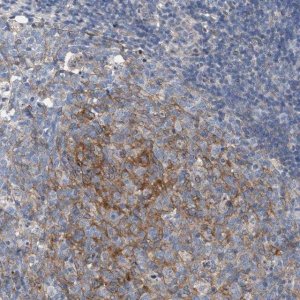 Anti-ARPC5L antibody produced in rabbit 