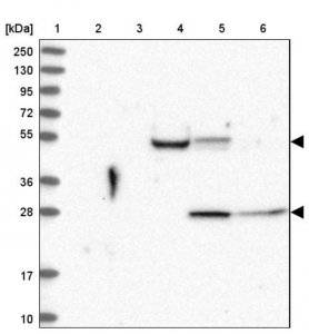 Anti-ARPIN antibody produced in rabbit HPA040513-100UL