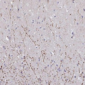 Anti-ARPP19 antibody produced in rabbit 