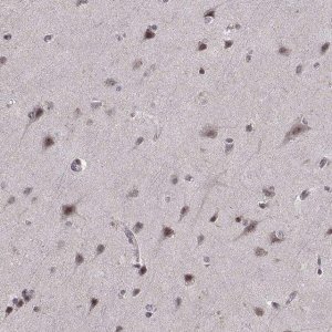 Anti-ARRB1 antibody produced in rabbit 