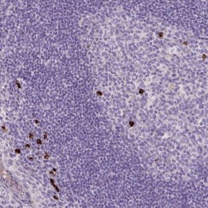 Anti-ARRDC2 antibody produced in rabbit 
