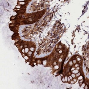 Anti-ARRDC4 antibody produced in rabbit 