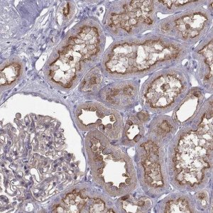 Anti-ARSE antibody produced in rabbit 