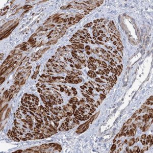 Anti-ARSI antibody produced in rabbit 