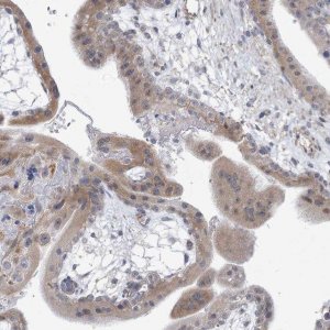 Anti-ARSI antibody produced in rabbit 