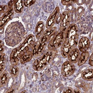 Anti-ARSK antibody produced in rabbit 