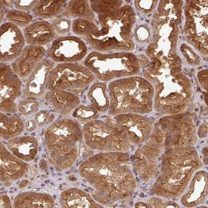 Anti-ART1 antibody produced in rabbit 