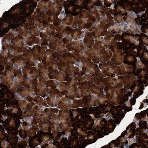 Anti-ART5 antibody produced in rabbit 
