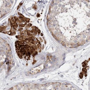 Anti-ARV1 antibody produced in rabbit 