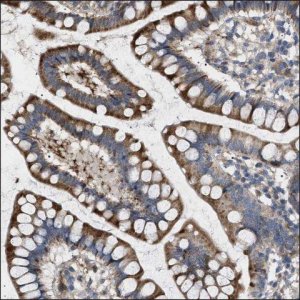 Anti-AS3MT antibody produced in rabbit HPA017856-100UL