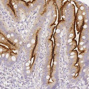 Anti-ASAH2 antibody produced in rabbit 