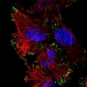 Anti-ASAH2 antibody produced in rabbit 