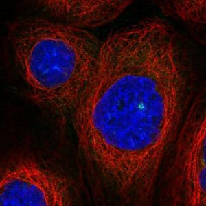 Anti-ASAP1 antibody produced in rabbit 
