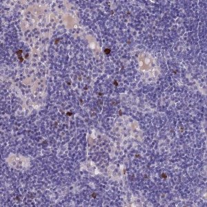 Anti-ASAP3 antibody produced in rabbit 