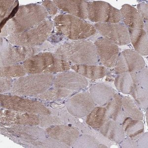 Anti-ASB16 antibody produced in rabbit 