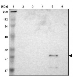 Anti-ASB6 antibody produced in rabbit 